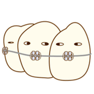 矯正器具を装着した歯のイラスト